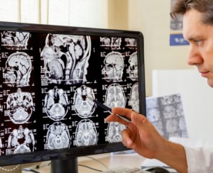 Sperimentazione al Centro Mente-Cervello